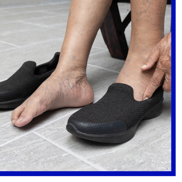 How Lift Chairs Promote Healthy Circulation
